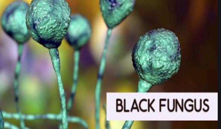 Black Fungus Update : Black Fungus से 118 केस आये है, 2 की मौत