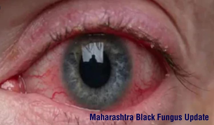 Maharashtra Black Fungus Update : ब्लैक फंगस से 1780 केस आये, 120 की मौत